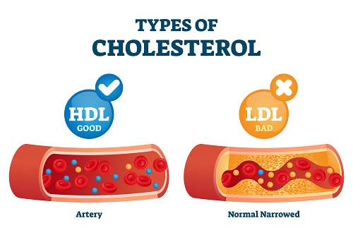 ldl-is-the-bad-cholesterol-in-body-how-to-get-rid-of-it-bowtie